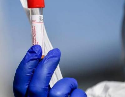 Географія захворюваності мешканців Львівщини на COVID-19