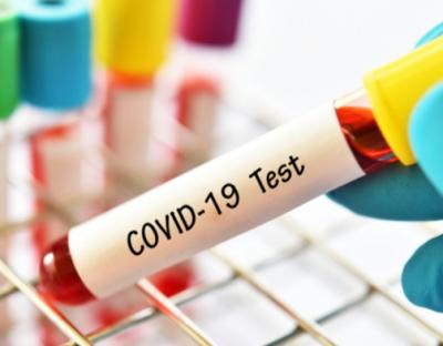 На Львівщині зафіксували 39 нових випадків захворювання на коронавірус