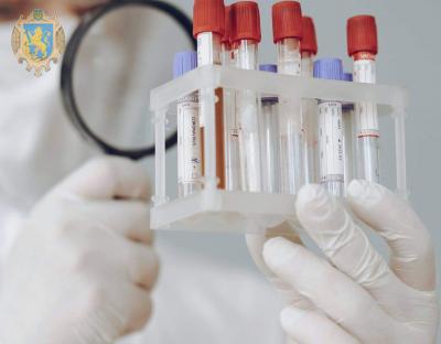 У 463 мешканців області за добу підтвердили коронавірус, з них 138 – у Львові