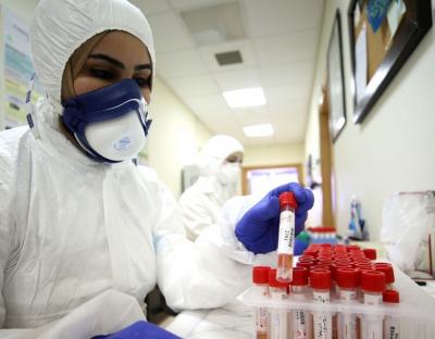 На Львівщині зафіксовано 48 нових випадків захворювання на коронавірус