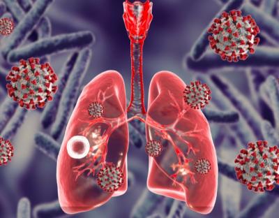 24 березня – Всесвітній день боротьби з туберкульозом