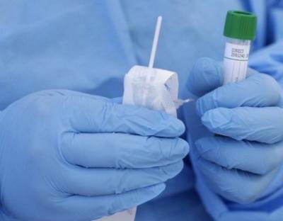 В області зафіксували 403 нових випадків захворювання на коронавірус