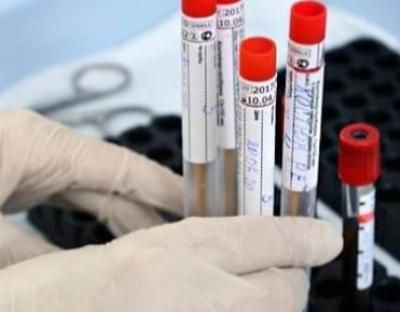 Коронавірус за добу підтвердили у 554 мешканців області