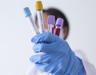 COVID-19: за добу 117 нових хворих і 1 летальний випадок