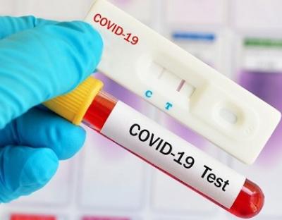 На Львівщині зафіксовано 1342 нових випадки захворювання на коронавірус