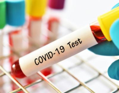 На Львівщині зафіксовано 81 новий випадок захворювання на коронавірус