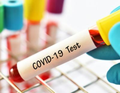 На Львівщині зафіксовано 84 нових випадки захворювання на коронавірус