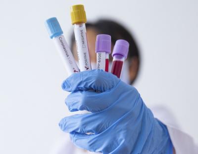 На Львівщині зафіксували 183 нових випадки захворювання на коронавірус. Госпіталізували – 65 осіб