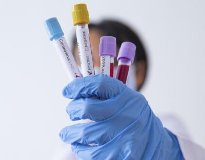 На Львівщині зафіксовано 113 нових випадків захворювання на коронавірус