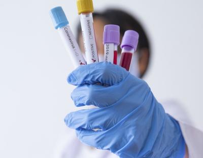 На Львівщині зафіксовано 432 нових випадків захворювання на коронавірус