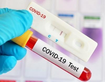 На Львівщині зафіксовано 1121 новий випадок захворювання на коронавірус